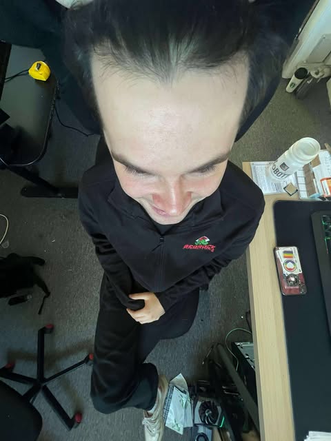 forehead